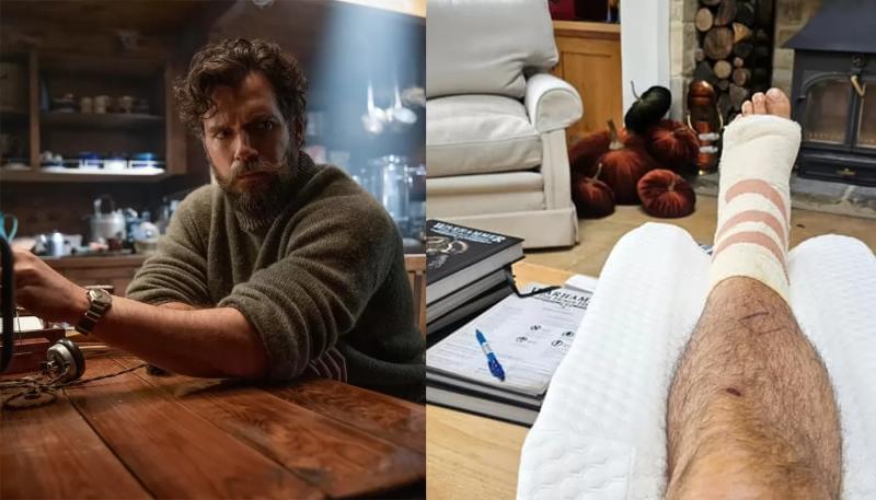 Генри Кавилл показал травму со съемок новой версии "Горца"